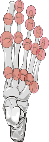 Septic Arthritis Distribution