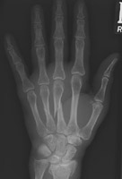  - Click on the image for a larger version