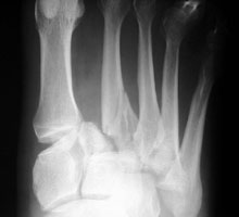  - Click on the image for a larger version