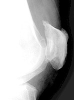 Lateral Knee - Click on the image for a larger version